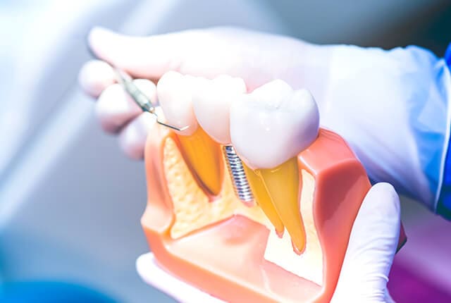 インプラント・歯科口腔外科